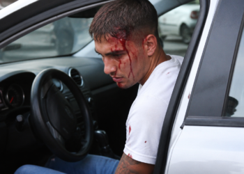 Roban violentamente a un futbolista de Vélez: agredido con un arma y herido en la cabeza