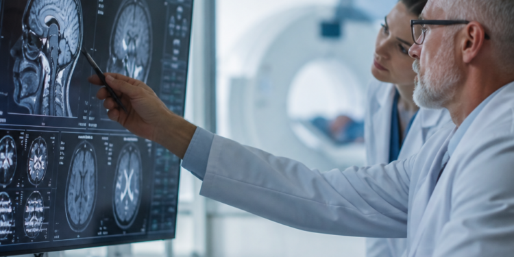 Avances en la inmunoterapia para la prevención del Alzheimer